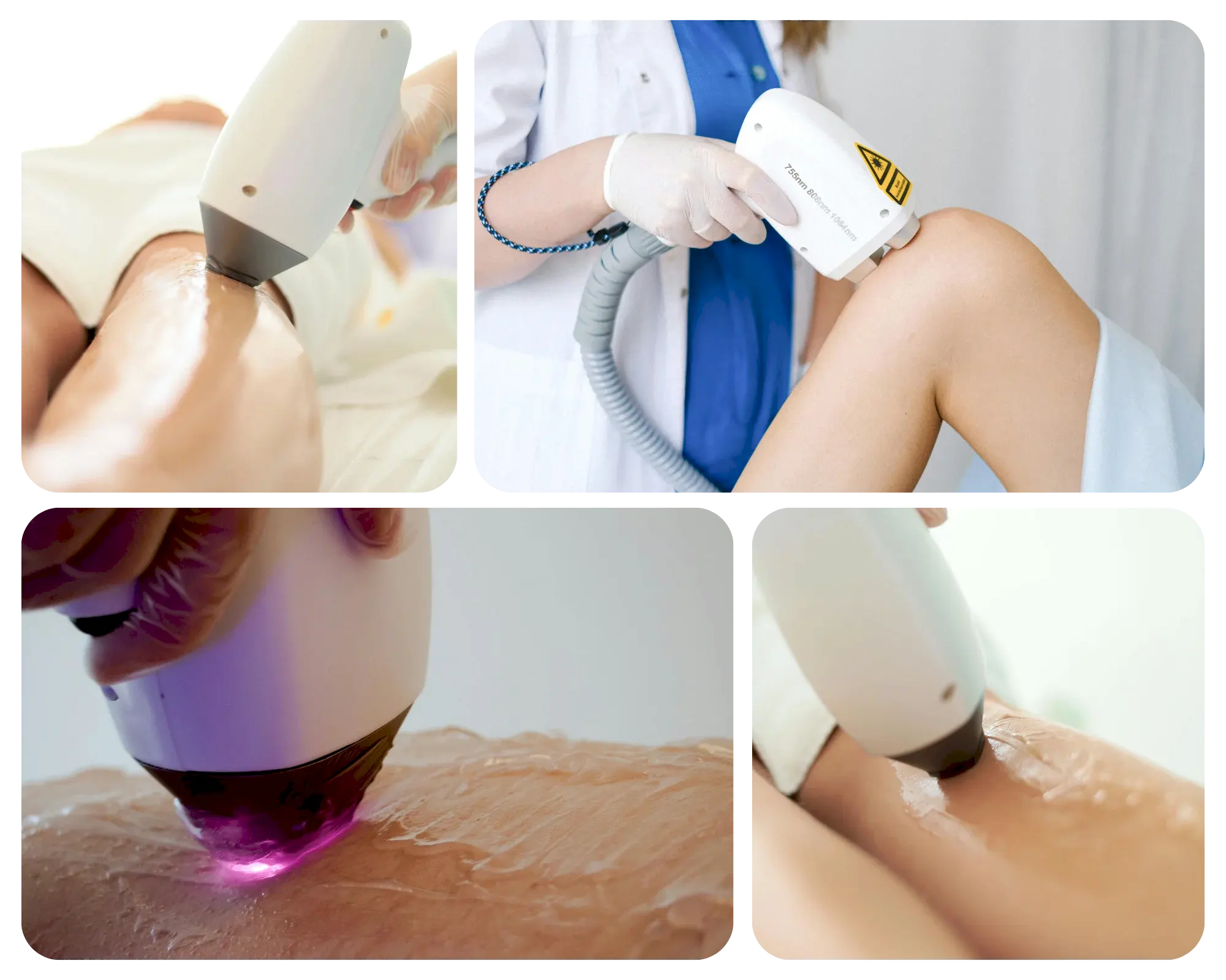 Lazer Epilasyon Hizmetleri